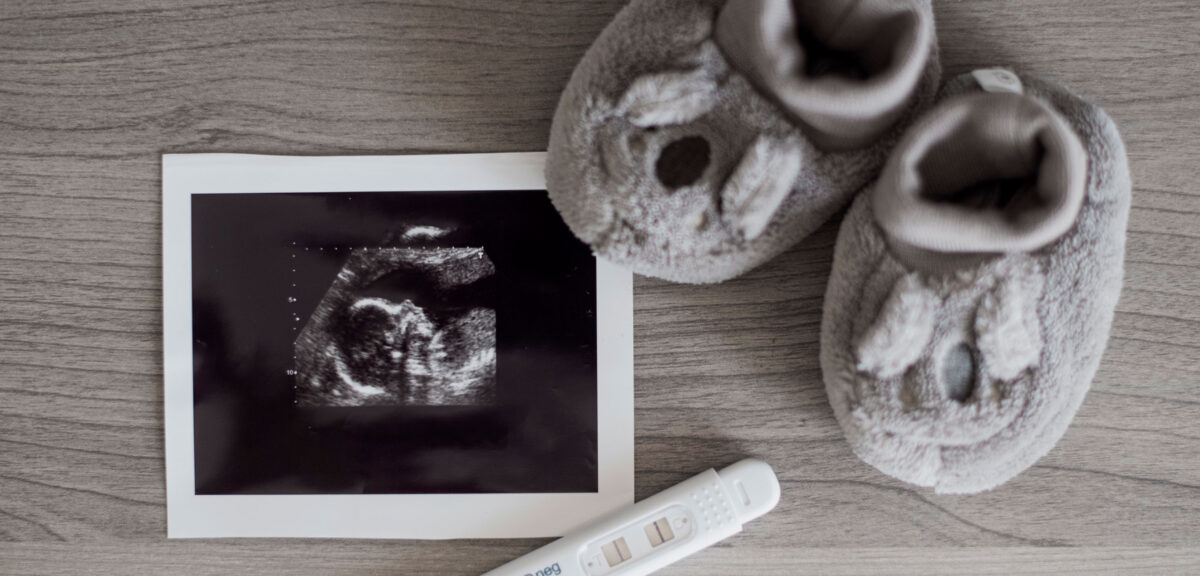 Vientres de alquiler y dignidad humana